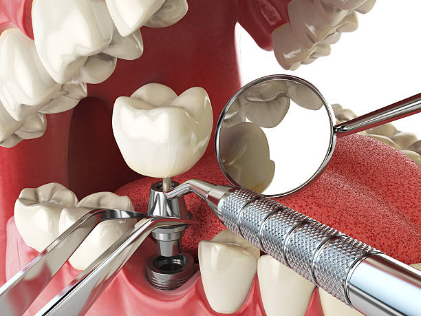 Best Emergency Denture Repair in Hickory, NC